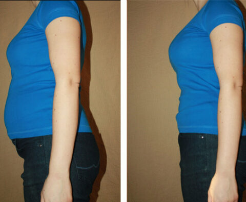 Signs and Symptoms of Weight Loss in Anxiety and Depression